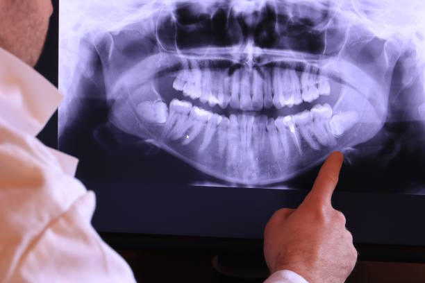 Best Orthodontic Emergency Dentist in Bensville, MD